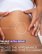 A-Derma Epitheliale A.H. Duo Massage Gel-Oil masažni gel-olje za brazgotine in strije 40 ml
