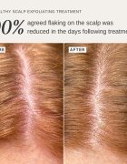 Alpha-H Healthy Scalp eksfoliacijska raztopina za glavo 100 ml