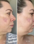 Alpha-H Vitamin A serum z vitaminom A 25 ml