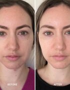 Alpha-H Vitamin B serum za krepitev kožne pregrade 25 ml