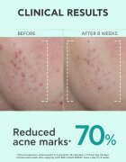 Apivita Just Bee Clear Serum serum za mastno in problematično kožo 30 ml