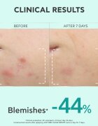 Apivita Just Bee Clear Serum serum za mastno in problematično kožo 30 ml