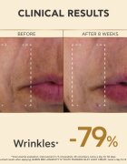 Apivita Queen Bee Longevity lahka krema za učvrstitev obraza 50 ml