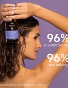 Apivita Sensitive Scalp Shampoo šampon za občutljivo in razdraženo lasišče brez sulfatov 250 ml