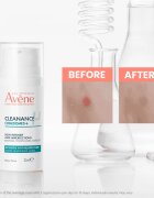 Avène Cleanance Comedomed+ intenzivna nega proti nepravilnostim na aknasti koži 30 ml