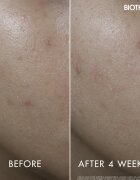 Biotherm Aquasource+ Vitamin Glow Gel gel za obraz 50 ml