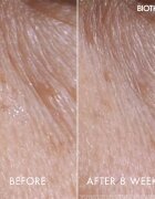 Biotherm Blue Peptides Eyes Lips Contour Reshaper nega za predel okoli oči in ustnic 15 ml