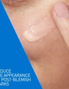 CeraVe Control Cleanser & Retinol Serum Duo kompleksna nega proti nepravilnostim na aknasti koži