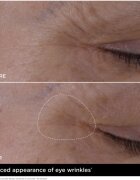 Clarins Double Serum Eye serum proti gubam za predel okoli oči s hranilnim učinkom 20 ml