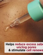 Clarins My Pure-Reset Resurfacing Blemish Serum obnovitveni serum za mastno k aknam nagnjeno kožo 30 ml
