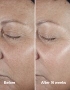 Clinique Smart Clinical™ Repair Wrinke Correcting Serum serum za obraz za korekcijo gub 100 ml