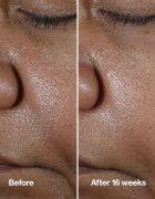Clinique Smart Clinical™ Repair Wrinke Correcting Serum serum za obraz za korekcijo gub 100 ml
