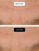 Cocunat Clinical Beauty Filler set proti staranju kože