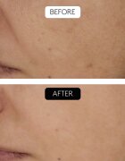 Cocunat Clinical Beauty Filler set proti staranju kože