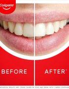 Colgate Max White Ultra Multi Protect zobna pasta za beljenje zob 50 ml