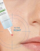 Dermedic Normacne Therapy lokalna nega proti aknam 15 g