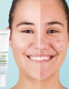 Dermedic Normacne Therapy vlažilna krema za aknasto kožo 40 ml