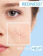 Dermedic Redness Calm micelarna voda za občutljivo kožo nagnjeno k rdečici 500 ml