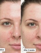 Dr. Jart+ Cicapair™ So Soothing Treatment lokalna nega za zmanšanje rdečice 30 ml