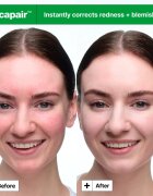 Dr. Jart+ Cicapair™ Soothing Color Correcting Treatment SPF 30 intenzivna krema za zmanjšanje rdečice SPF 30 30 ml