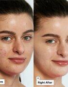 Dr. Jart+ Cicapair™ Tiger Grass Color Correcting Treatment intenzivna krema za zmanjšanje rdečice 30 ml