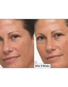 Dr. Jart+ Prejuvenation Cream with Bakuchiol regeneracijska in učvrstitvena krema proti znakom staranja 50 ml