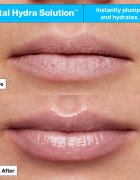 Dr. Jart+ Vital Hydra Solution™ Hydrating Lip Mask Jelly Bear Edition vlažilna maska za ustnice 20 ml
