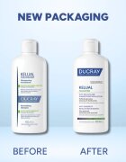 Ducray Kelual Squanorm Regulating Treatment Shampoo Oily Dandruff šampon proti mastnemu prhljaju 400 ml