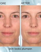 Elizabeth Arden Hyaluronic Acid + Peptides Ceramide serum za obraz v kapsulah s ceramidy a peptidy 30 caps.