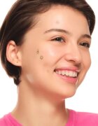 essence Spot Squad Pimple Patches obliži za problematično kožo 32 kos