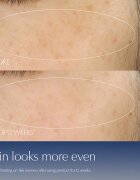 Estée Lauder Advanced Night Repair Serum Synchronized Multi-Recovery Complex serum proti gubam 7 ml