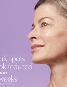 Estée Lauder Perfectionist Pro Rapid Brightening Treatment with Ferment³ + Vitamin C posvetlitveni serum z vitaminom C proti temnim madežem 50 ml