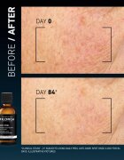 FILORGA DAILY PEEL ANTI-DARK SPOT piling za obraz proti temnim madežem 50 ml