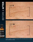 FILORGA DAILY PEEL ANTI-WRINKLE piling proti gubam 50 ml