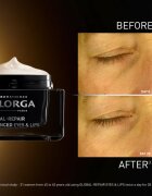 FILORGA GLOBAL-REPAIR ADVANCED EYES & LIPS krema proti gubam za konture oči in ustnic 15 ml