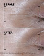 FILORGA TIME-FILLER SHOT intenzivni serum proti prvim znakom staranja kože 15 ml
