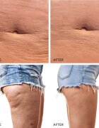 FOREO BEAR™ 2 body mikrotokovna naprava za čvrstejši obraz za telo Lavender 1 kos