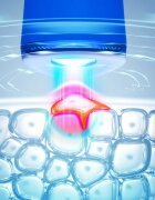 FOREO ESPADA™ 2 pero z modro lučko za pomirjenje pojava aken Cobalt Blue 1 kos