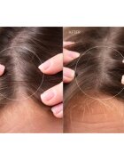 FOREO FAQ™ Scalp Recovery & Thick Hair Probiotic Serum probiotični serum za obnovo las in lasišča 60 ml