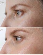FOREO IRIS™ Firming Eye Serum pomlajevalni serum za predel okoli oči 15 ml