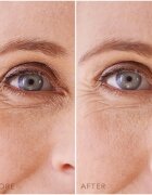 FOREO IRIS™ Hydrogel Eye Mask globinsko vlažilna maska za predel okoli oči 60x1 kos