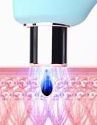 FOREO KIWI™ vakuumski pripomoček za odstranjevanje ogrcev z modro svetlobo LED 1 kos