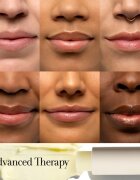 fresh Sugar Advanced Therapy Treatment Lip Balm vlažilni balzam za ustnice 43 g
