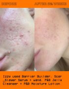 Glow Hub The Scar Slayer serum za osvetljevanje proti pigmentnim madežem 30 ml