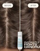 Goldwell Dualsenses Scalp Specialist Anti-Dandruff Shampoo šampon proti prhljaju 250 ml