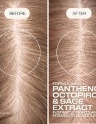 Goldwell Dualsenses Scalp Specialist Anti-Dandruff Shampoo šampon proti prhljaju 250 ml