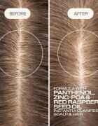 Goldwell Dualsenses Scalp Specialist Clarifying Shampoo globinsko čistilni šampon 1000 ml