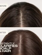 Goldwell Dualsenses Scalp Specialist Clarifying Shampoo globinsko čistilni šampon 250 ml