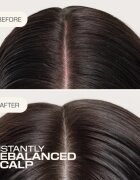 Goldwell Dualsenses Scalp Specialist Rebalance & Hydrate Fluid vlažilni fluid za obnovo lasišča 150 ml