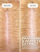 Goldwell Dualsenses Scalp Specialist Sensitive Foam Shampoo penast šampon za občutljivo lasišče 250 ml